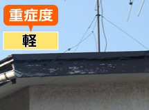 重症度:軽