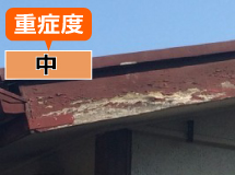 重症度:中